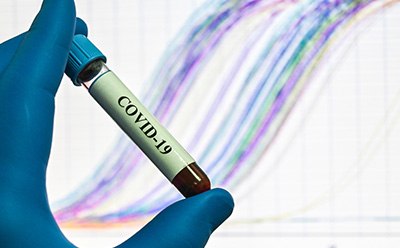 PCR-based SARS-CoV-2 sample testing SARS-CoV-2 blood sample in test tube