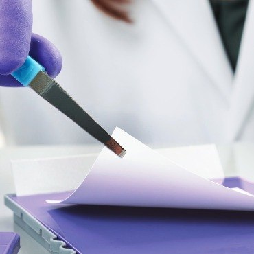 Transferencia de proteínas a membrana de PVDF para detección utilizando técnicas de inmunoelectrotransferencia. Transferencia de proteínas a membrana de PVDF para detección utilizando técnicas de inmunoelectrotransferencia.
