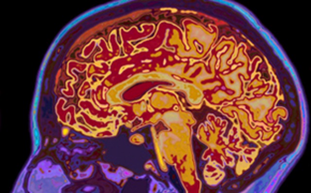 Investigaci&oacute;n en neurociencia