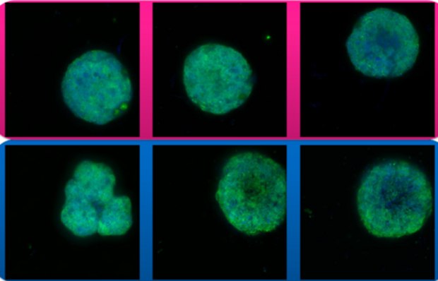 ULA Plates Vs Competition Confocal microscopy of HeLa cells using Millicell ULA and Competitor A ULA plates
