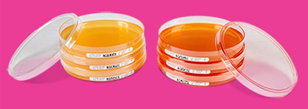 Various petri dishes filled with agar, used for microbial sampling and air monitoring