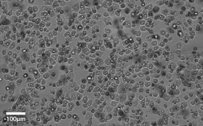 Microscopy Image of Primary Hepatocytes Primary hepatocytes imaged at 20x magnification. Light grey image with small darker grey and black circles that indicate the cells that cover the entire image.