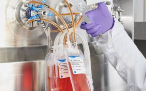 A picture featuring NovaSeptum® GO sampling systems connected to a bioreactor.
