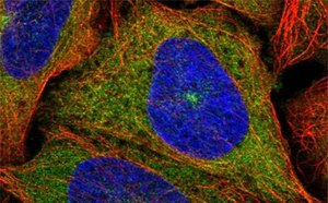 Prestige Antibodies® anti-KIF5B producidos en el conejo Prestige Antibodies® muy bien caracterizados y validados.