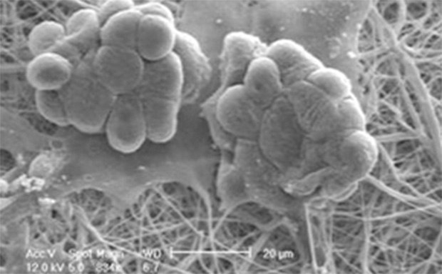 Cells Grown Nanofiber Structural Insert Scanning electron microscope image depicting clusters of microbial cells adhering to a fibrous network, displayed in monochrome for detailed texture analysis.