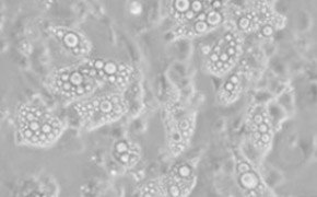 Las c&eacute;lulas est&aacute;n llenas de c&iacute;rculos de distintos tama&ntilde;os que indican gotas de l&iacute;pidos. Las gotas de l&iacute;pidos y las c&eacute;lulas visibles ocupan el primer plano de la imagen.