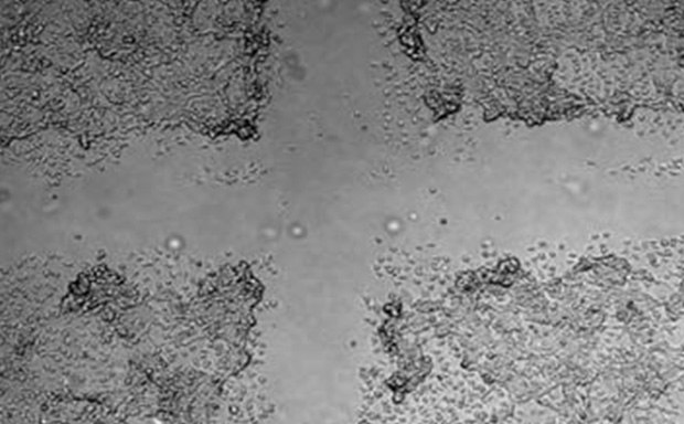 The Cell Comb scratch assay measures cell migration Microscopy image of the Cell Comb scratch assay for cell migration