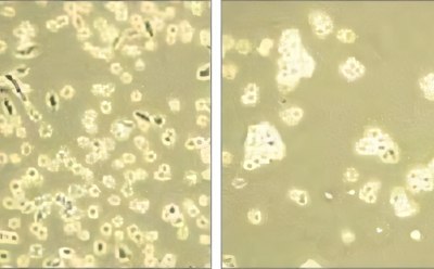 Cell dissociation En esta imagen se presenta un análisis microscópico comparativo de estructuras celulares, mostrando dos fotomicrografías distintas. A la izquierda, se observa un denso agregado de células o microorganismos, indicativo de un entorno de crecimiento posiblemente activo. La fotomicrografía de la derecha revela una distribución más dispersa, lo que posiblemente refleja el impacto de las condiciones experimentales variables en el comportamiento celular o la densidad de población.