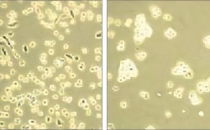 En esta imagen se presenta un análisis microscópico comparativo de estructuras celulares, mostrando dos fotomicrografías distintas. A la izquierda, se observa un denso agregado de células o microorganismos, indicativo de un entorno de crecimiento posiblemente activo. La fotomicrografía de la derecha revela una distribución más dispersa, lo que posiblemente refleja el impacto de las condiciones experimentales variables en el comportamiento celular o la densidad de población.