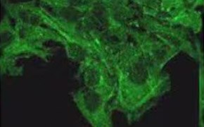 Peque&ntilde;os puntos cubren la superficie de las c&eacute;lulas, por lo que ning&uacute;n punto es completamente visible. Las c&eacute;lulas cubren la parte superior de la imagen y se expanden hacia la parte inferior central de la imagen.