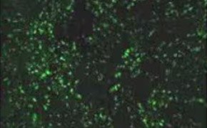 Peque&ntilde;os puntos cubren la superficie de las c&eacute;lulas, y cada punto es visible desde otro. Las c&eacute;lulas cubren la totalidad de la imagen.