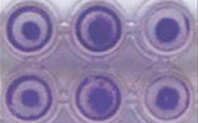 HT 1080 Cells Invasion A close-up image of a 96-well plate with each well containing HT-1080 cells with a distinct darker circular pattern in the center. The wells are arranged in two rows of three.
