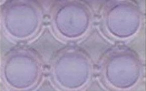 ht 1080 Cells Invasion A close-up image of a 96-well plate with each well containing HT-1080 cells. The wells are arranged in two rows of three.