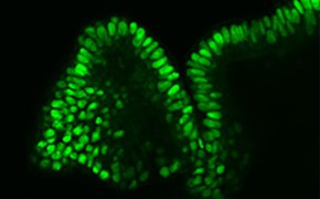 Cultivo celular tridimensional
