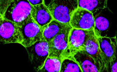 Mammalian cells cultured from cell lines Tinción fluorescente de células de mamífero cultivadas