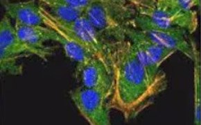Peque&ntilde;os puntos cubren la superficie de las c&eacute;lulas, de modo que ning&uacute;n punto es completamente visible. La F-actina es visible en las c&eacute;lulas como largas l&iacute;neas rectas que cubren la c&eacute;lula. El n&uacute;cleo es visible como un &oacute;valo en el centro de cada una de las c&eacute;lulas. Estas c&eacute;lulas cubren la parte superior de la imagen y se extienden hasta la parte inferior central de la misma.