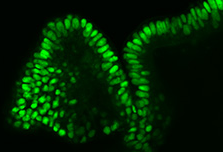 Tinción fluorescente de organoides colónicos derivados de células iPS humanas, SCC300 Tinción fluorescente de organoides colónicos derivados de células iPS humanas, SCC300