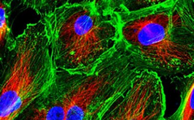 Primary Cell Culture La imagen es una vista microscópica que muestra diversas estructuras celulares. Presenta células con núcleos azules, fibras citoesqueléticas verdes y mitocondrias rojas.