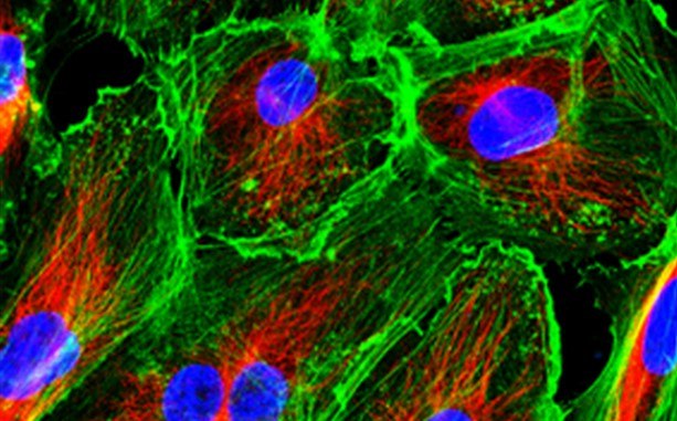 Primary cells in culture Primary Cells