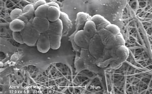 Imagen de microscopio electrónico de barrido que muestra dos grupos de estructuras redondas y bulbosas semejantes a colonias microbianas, adheridas a una matriz fibrosa. La imagen es en blanco y negro, lo que destaca la textura y el detalle de los microorganismos y las fibras, con una barra de escala que indica una medida de 20 micrómetros.