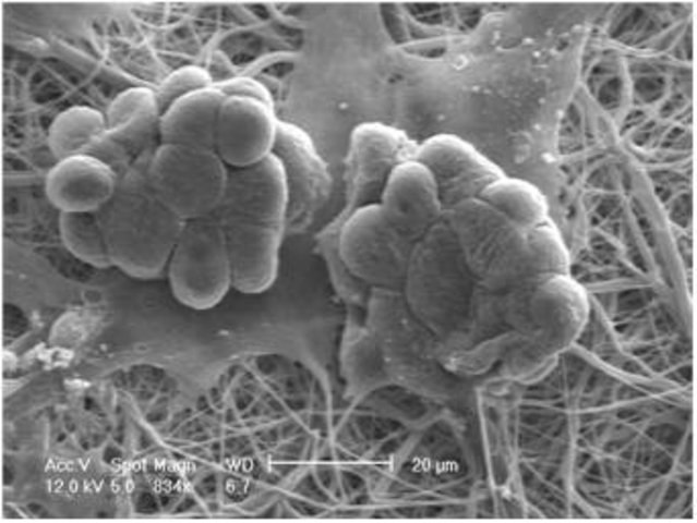 Imagen de microscopio electr&oacute;nico de barrido que muestra dos grupos de estructuras redondas y bulbosas semejantes a colonias microbianas, adheridas a una matriz fibrosa. La imagen es en blanco y negro, lo que destaca la textura y el detalle de los microorganismos y las fibras, con una barra de escala que indica una medida de 20 micr&oacute;metros.