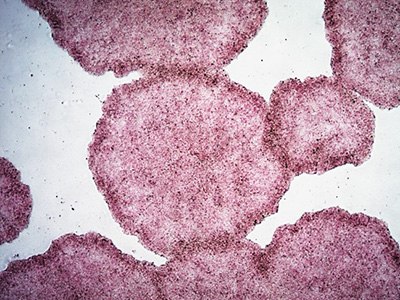 H9 human ES cells stained with alkaline phosphatase (AP) La imagen parece mostrar un conjunto de manchas irregulares de color rosa violáceo sobre un fondo pálido.