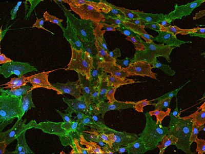 Fluorescent ICC staining of mesenchymal stem cells Citoblastos mesenquimatosos teñidos con fluorescencia para inmunocitoquímica