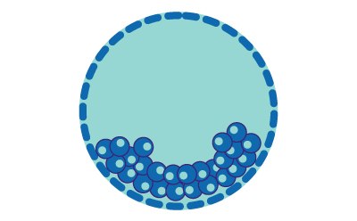 Illustration of numerous small, round cells clustered at the bottom of a blue circle, representing a blastocyst hatching. Illustration of numerous small, round cells clustered at the bottom of a blue circle, representing a blastocyst hatching.