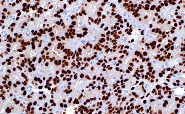 IHC Staining Micrograph Portaobjetos de control Cell Marque™