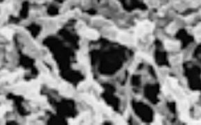 Filter Membranes
