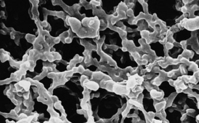 Mixed cellulose esters membrane Scanning electron microscope image of a mixed cellulose esters (MCE) membrane