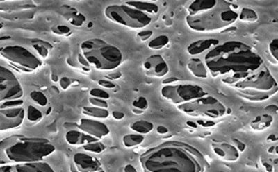 PES membrane filter Scanning electron microscope image of a polyethersulfone (PES) membrane