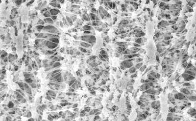 PTFE membrane filter Scanning electron microscope image of a polytetrafluoroethylene (PTFE) filter