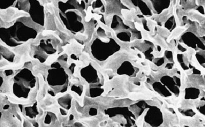 PVDF membrane filter Scanning electron microscope image of a polyvinylidene fluoride (PVDF) membrane filter