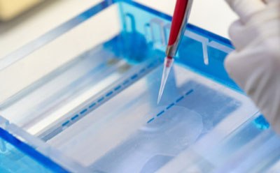 Agarose gel electrophoresis Electroforesis, transferencia y cuantificación de ácidos nucleicos