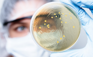 Un primer plano de una placa de Petri sostenida por una mano enguantada, que contiene una sustancia amarilla, lo que indica un experimento o cultivo de laboratorio.
