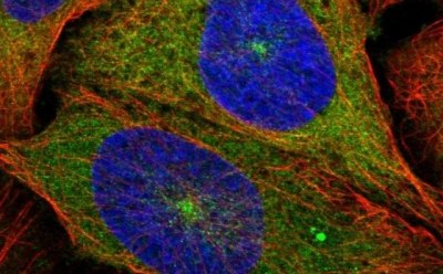 Prestige Antibodies® anti-KIF5B producidos en el conejo Prestige Antibodies® muy bien caracterizados y validados. Prestige Antibodies® anti-KIF5B producidos en el conejo Prestige Antibodies® muy bien caracterizados y validados.