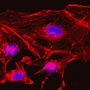 Primary antibodies Anticuerpos primarios