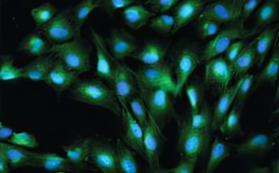 Secondary Antibodies - Immunofluorescence Exuberante tejido de granulación equino teñido utilizando Anti-von Wille