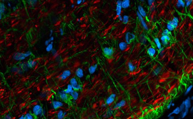 Secondary Antibodies Corte congelado de nervio óptico de rata teñido con anticuerpo anti-neurofilamento H de ratón y anticuerpo CF568 de cabra anti-ratón (axones y dendritas, rojo), anticuerpo anti-GFAP de conejo y CF488A de cabra anticonejo, muy adsorbido en cruz (células gliales, verde). Los núcleos se tiñen con RedDot2 (cian).