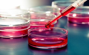 Primer plano en el que se observan varias placas de Petri llenas de un medio líquido de color rosa. En primer término, una pipeta dispensa un líquido rojo en una de las placas de Petri. El fondo muestra más placas de Petri y el ambiente sugiere un entorno estéril y controlado típico de la investigación biológica.