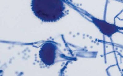 Culture, smear, Lactophenol blue staining Micrografía de tinción bacteriológica de frotis con azul de lactofenol