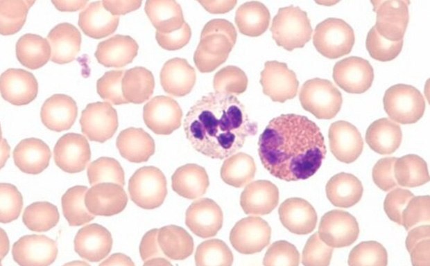 Hematological stains Tinciones para hematología