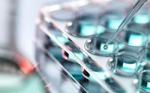 A close-up image of a multi-well plate with several circular wells filled with a blue liquid. A pipette is being used to transfer a droplet into one of the wells, highlighting a laboratory setting focused on precise liquid handling and analysis.
