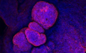 Organoids under scope Organoid under a microscope stained purple and red