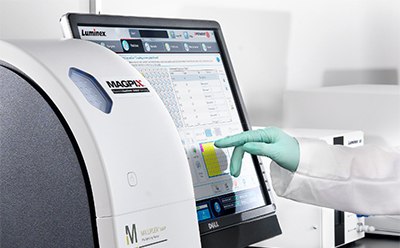 Belysa® Immunoassay Curve Fitting Software