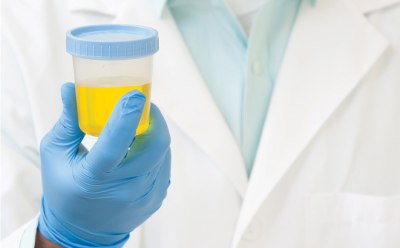 Drugs of Abuse in Urine
