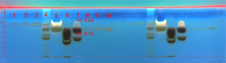 Developed and derivatized plate at 366 nm. Chromatographic data shown further down in tabulated form. Developed and derivatized plate at 366 nm. Chromatographic data shown further down in tabulated form.