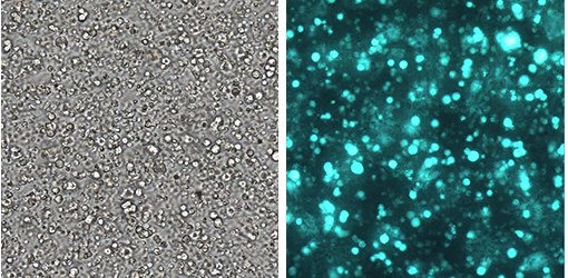 3D culture of human neural stem cells using PhotoHA 3D culture of human neural stem cells using PhotoHA®