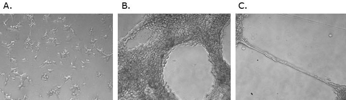 Neurite outgrowth of PC12 rat neuronal cells using ECM Gel Matrix. A) Normal morphology of PC12 cells (88022401) cultured on uncoated plasticware. B, C) PC12 cells grown on ECM Gel Matrix form neurites with complex 3D neural networks after 24-48 hours of culture. Newrite outgroth
